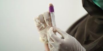 NHS patients receive first home-grown blood plasma treatments